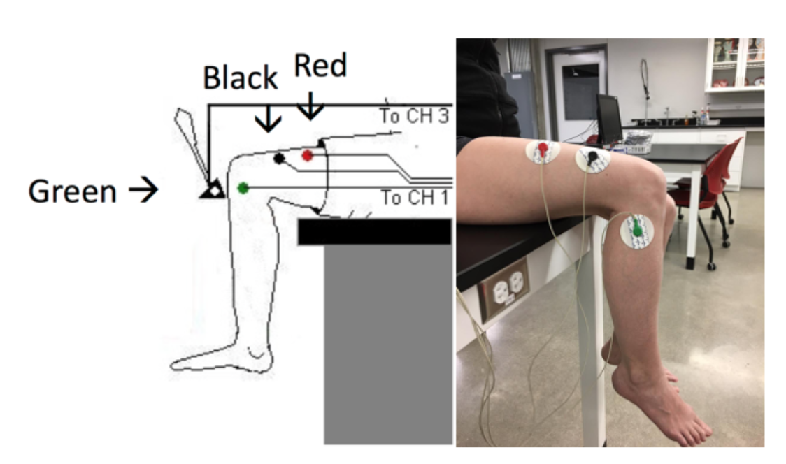 Electrode placement on leg for use with reflex hammer with digital diagram