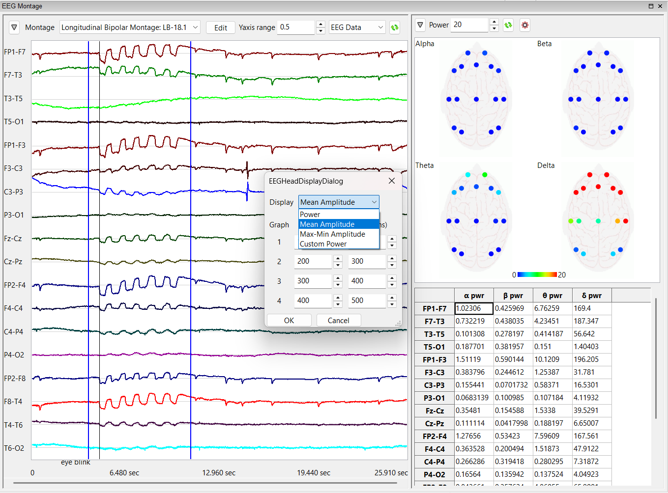 labscribe - 5 EEG Head Display