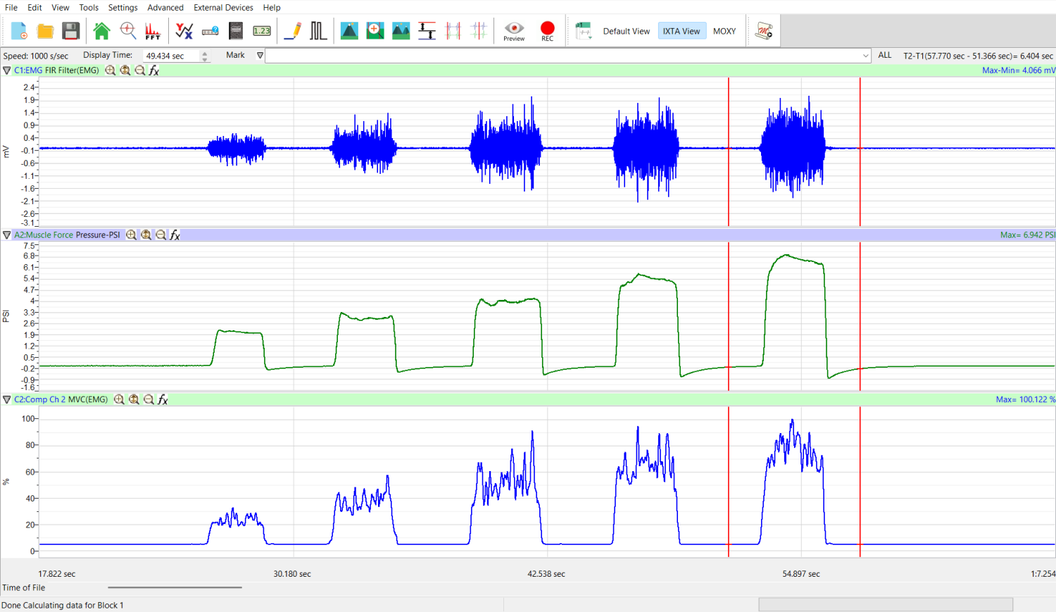 LabScribe - EMG MCV