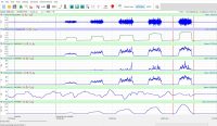 EMG Module Example in LabScribe