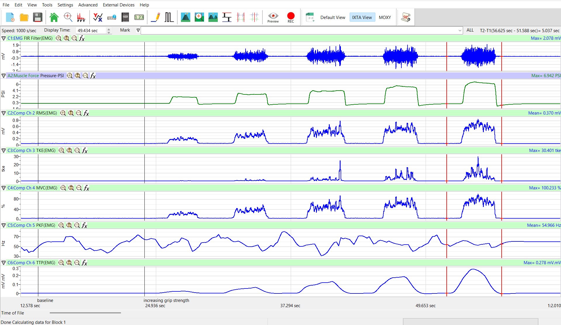 EMG Module Example in LabScribe