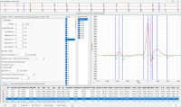 LabScribe ECG Analysis