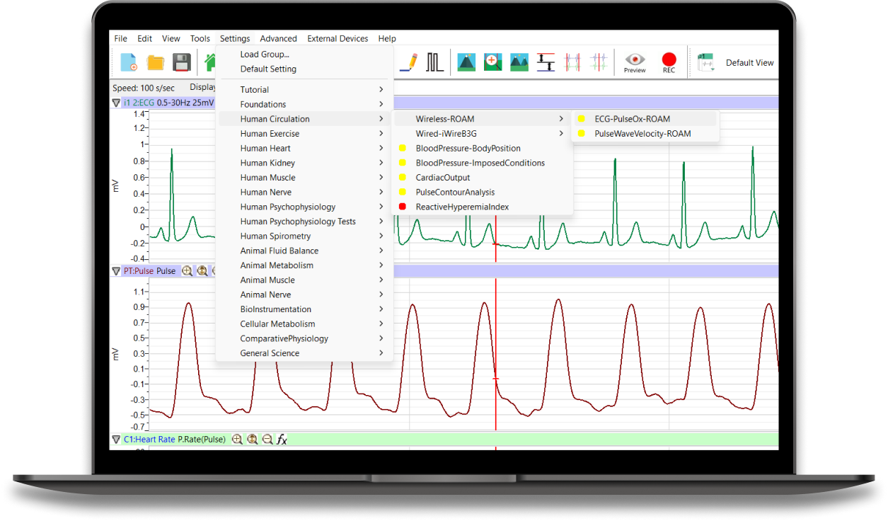 Preset Settings in LabScribe Highlighting the Color-Coded Labs