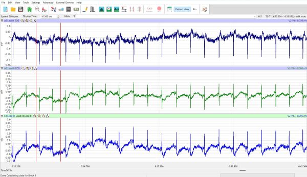 Neonatal Mouse ECG